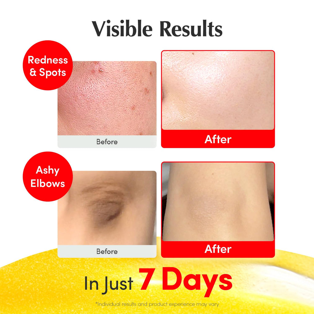 EQQUAL BERRY Bakuchiol Plumping Serum - Wrinkle Minimizer 30ml